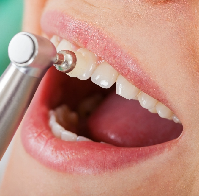 Preventative Dentistry