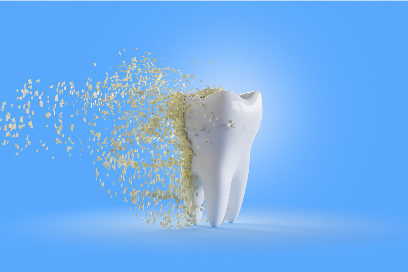 tooth with plaque coming off