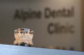 dental services at alpine dental clinic model of teeth at alpine dental clinic