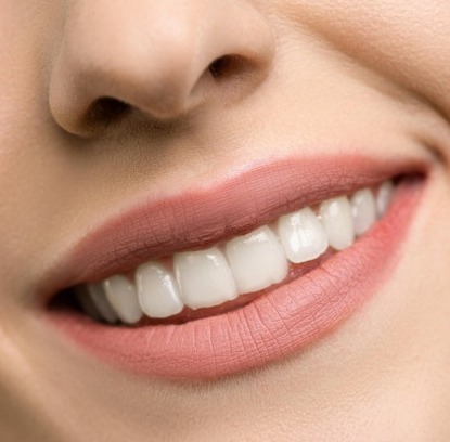 Cosmetic Dentistry swift current Cosmetically improved teeth