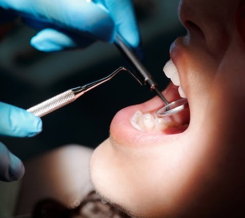 dentistry with nitric oxide