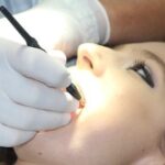dental patient getting teeth sealant