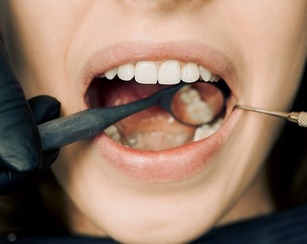 dentist inspecting a mouth for oral cancer