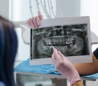 patient x-ray of mouth