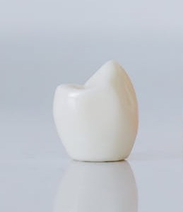 dental crown which fell out
